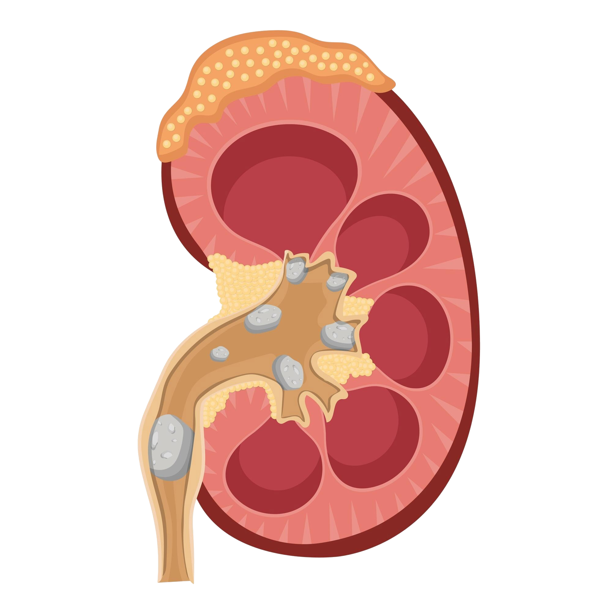 BreakingKidney treatment illustration